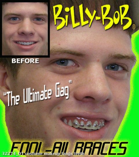 Billy-Bob Teeth - Braces